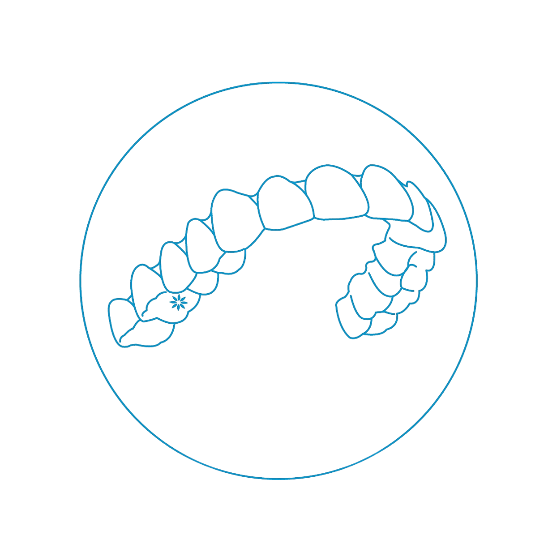 CLEAR ALIGNER